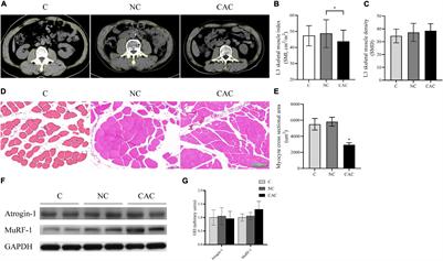 Phosphorylation of Dynamin-Related Protein 1 (DRP1) Regulates Mitochondrial Dynamics and Skeletal Muscle Wasting in Cancer Cachexia